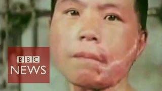 Hiroshima atomic bomb Survivor recalls horrors  BBC News [upl. by Adnarym918]