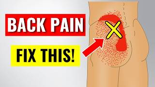 Beat Low Back Pain By Fixing This One Problem [upl. by Cristoforo]