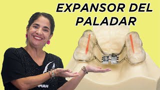 Expansor del paladar [upl. by Viva]