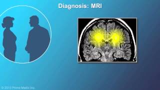 Diagnosis of Multiple Sclerosis [upl. by Iralav]