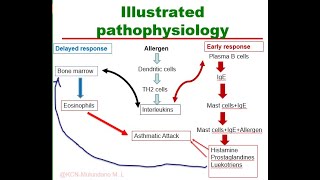 Pathophysiology of Asthma Illustrated [upl. by Tombaugh827]