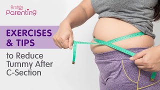 How to Reduce Tummy Fat After Csection Delivery  Exercise After C Section to Reduce Tummy [upl. by Ahsitnauq]