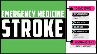 Acute management of Stroke Stroke Emergency management 2019 [upl. by Eillit]