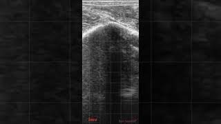 Endometritis en vaca lechera [upl. by Anyah]