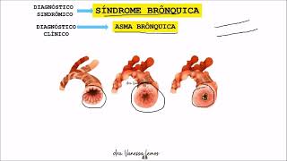 2 Síndromes Pleuropulmonares II [upl. by Luciano688]