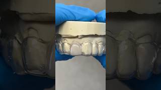 Filling in a Central Incisor lsk121shorts dental teeth [upl. by Dorelle]