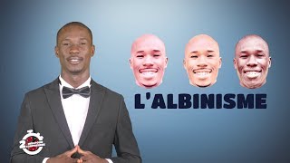 2 mn pour comprendre quotLALBINISMEquot du 23 Juillet 2018 par Polus Agathon [upl. by Cherian]