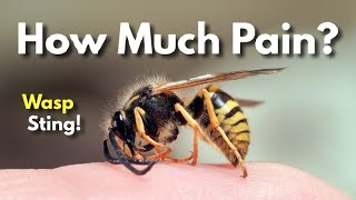 How Dangerous Is A Wasp Sting Explained [upl. by Oswal]