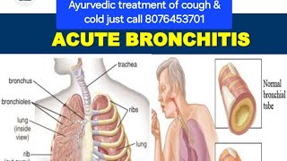 CoughColdBronchitisAcute bronchitisYtm AyurvedaAyurvedaYtm indiaNatural healingNatural herbs [upl. by Enytsuj]