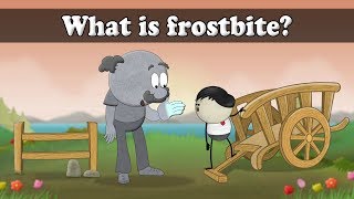 What is frostbite  aumsum kids science education children [upl. by Ilojna]