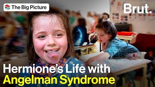 A Day in the Life with Hermione with Angelman Syndrome [upl. by Lebazi]