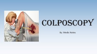 OampG Colposcopy  for medical students indications procedure abnormal results [upl. by Stephens117]