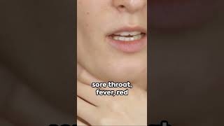 Strep Throat Causes Symptoms and Diagnosis [upl. by Jd183]