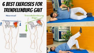 These Exercises Correct Your Abnormal Walking Pattern Trendelenburg Gait PhysiofitByDrMajid [upl. by Bill]