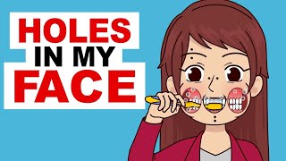 I Have Holes In My Face [upl. by Essam]