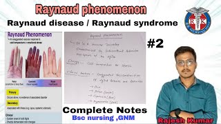 Raynaud phenomenon raynaud diseasesyndromeINTEGUMENTARYPROBLEMS BSCNURSING AND GNMrknursingpoint [upl. by Ytitsahc301]