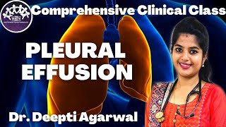 Pleural Effusion Clinical Case Presentation [upl. by Tse597]