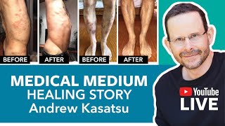 Medical Medium Healing Story Andrew Kusatsu⎜SEASON 1 Episode 10 [upl. by Karney]