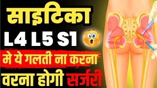 स्पाइन सर्जरी से कैसे बचेंL4 L5 Disc Bulge Treatment Without SurgeryDisc Bulge Treatment In Hindi [upl. by Aneehsor]