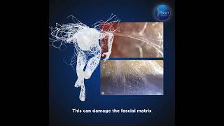 Uterus Fascial Adhesion Therapy fascia fasciarelease visceralmanipulation uterushealth uterus [upl. by Eibloc]