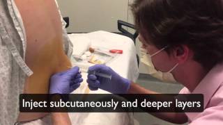 How to perform a lumbar puncture Lumbar puncture in the emergency department setting [upl. by Thatch606]