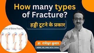 Common types of Bone fracture  Types of Fracture  How many types of Fracture fracture [upl. by Nadroj]