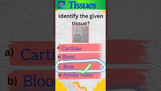 Tissues Part 4  Animal tissues  Class 9 Science  Connective tissue  shorts [upl. by Akemed]