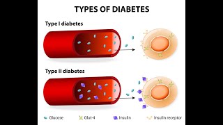 Pathogenesis of Diabetes Mellitus Type 1 and Type 2 [upl. by Atsillak]