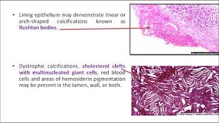 ORALPATH CHAP3 PART2 ODONTOGENIC CYSTS AND TUMOURSENGLISH [upl. by Dyane]