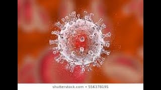 Kaposi sarcoma  Part 6   Diagnosis and staging of kaposi sarcoma  Pathology USMLE Step 1 [upl. by Eidnew]