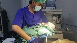 baby come out anesthesia craniosynostosis operation [upl. by Bolan800]