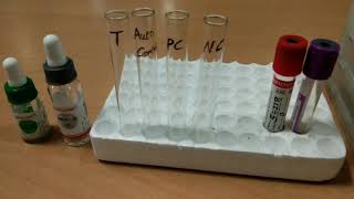 Indirect Coombs test by Tube method [upl. by Kornher384]