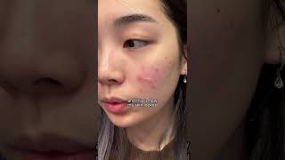 best korean skincare products to restore damaged skin barrier I MANYO BIFIDA TONER amp AMPOULE shorts [upl. by Robinia]