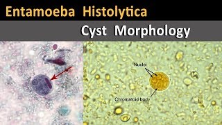 Entamoeba Histolytica Cyst Morphology [upl. by Aniram]