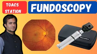 Fundoscopic examination  Fundoscopy made easy  Fundoscopy procedure  Fundoscopy eye test [upl. by Leanora958]