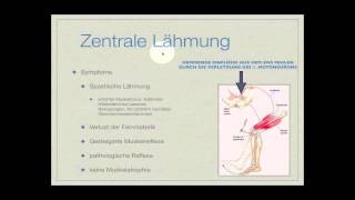 Basiskurs Neurologie Lähmungen Teil 214 [upl. by Recha154]