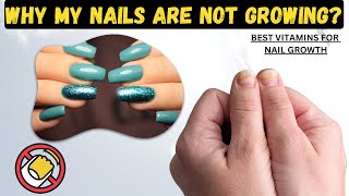 Struggling with Nail Growth Here’s Why and How to Fix It [upl. by Mokas]