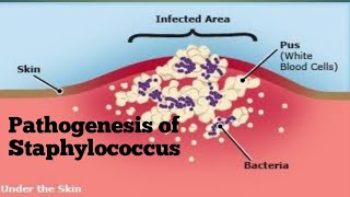 Pathogenesis of Staphylococcus [upl. by Aivul973]