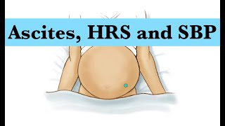 AscitesHRS and Spontaneous Bacterial peritonitis by ASM Minds Team [upl. by Carhart]