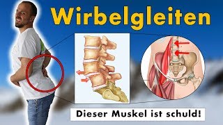 Gleitwirbel Wirbelgleiten wegtrainieren  GENAUE Ursache und 1 Übungen die NACHHALTIG hilft [upl. by Kcirevam]