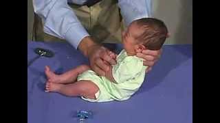 1423 Clinical Pediatrics Moro Reflex [upl. by Hairom595]