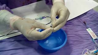 PDA closure preparation of Catheter and Occluder [upl. by Warp]