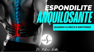 ESPONDILITE ANQUILOSANTE  EXAME FÍSICO QUADRO CLÍNICO e SINTOMAS  Fisioterapia Dr Robson Sitta [upl. by Editha668]