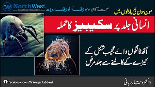 Kharish Khatam Karne Ka Tarika  Scabies Ka Ilaj in Urdu  Itching Treatment  Kharish Ka Fori Ilaj [upl. by Secnarfyram]