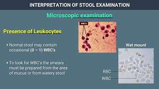 Interpretation of Stool Examination [upl. by Collin]