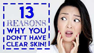 13 REASONS WHY YOU DONT HAVE CLEAR SKIN AND HOW TO FIX IT [upl. by Eedolem947]