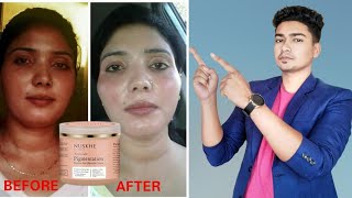 Nuskhe pigmentation cream by paras tomar  Review  Benefits and side effects [upl. by Aryaz632]