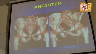 Diagnóstico por Imagen  Angiografía AngioTAC y AngioRMN [upl. by Ladin896]