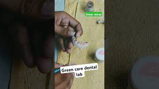 Applying the gingiva tissuedental ringtone songdentalgreens [upl. by Assirual]