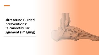 Ankle CFL Imaging [upl. by Conlin]